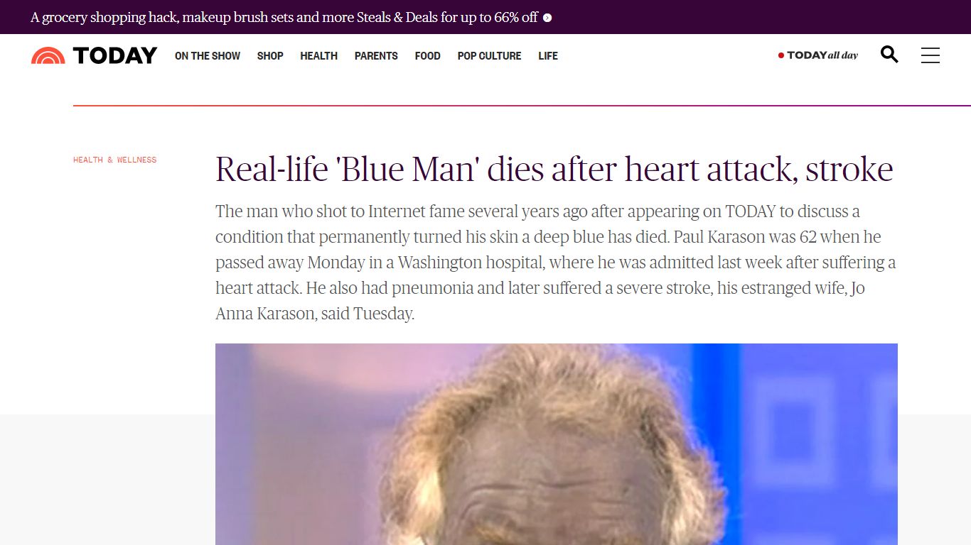 Real-life 'Blue Man' dies after heart attack, stroke - TODAY.com